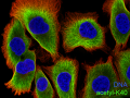 DU145-cytoskelet-b-labeled