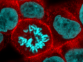 LNCaP_mitosis
