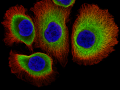 DU145-cytoskelet-a