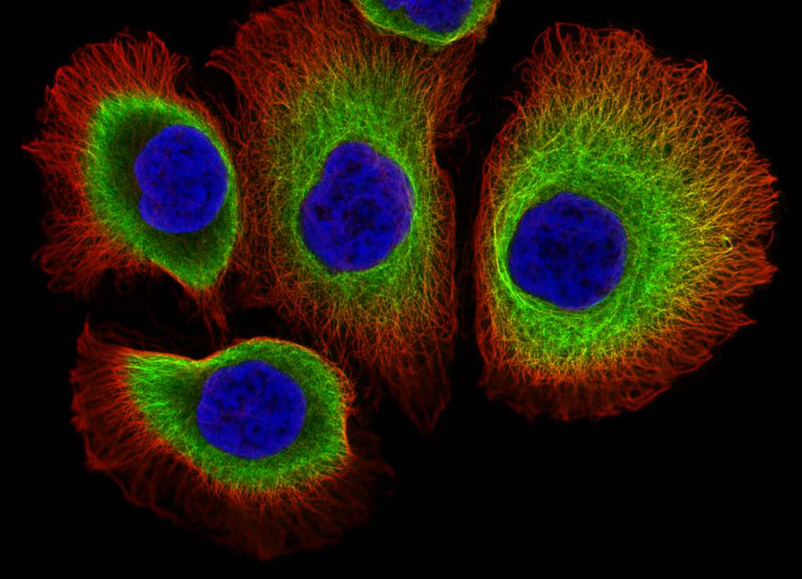 DU145-cytoskelet-a