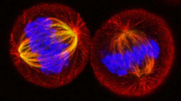 Dividing_cells
